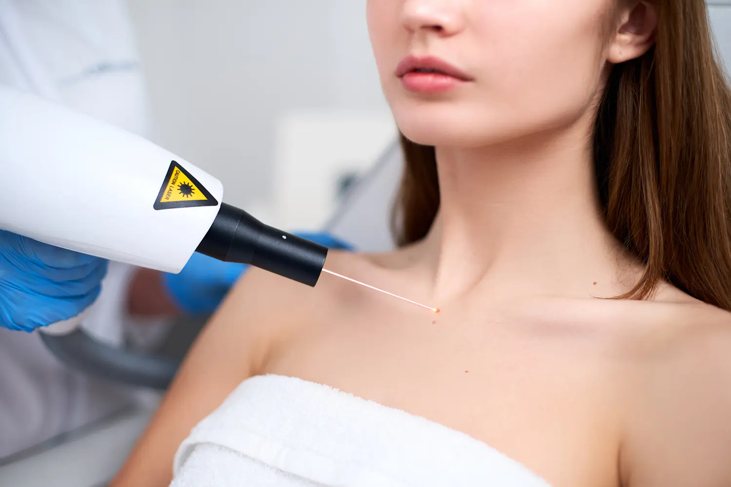Laser treatment on woman's skin