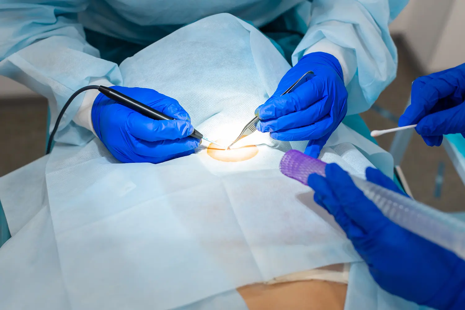 Surgeons performing a medical operation