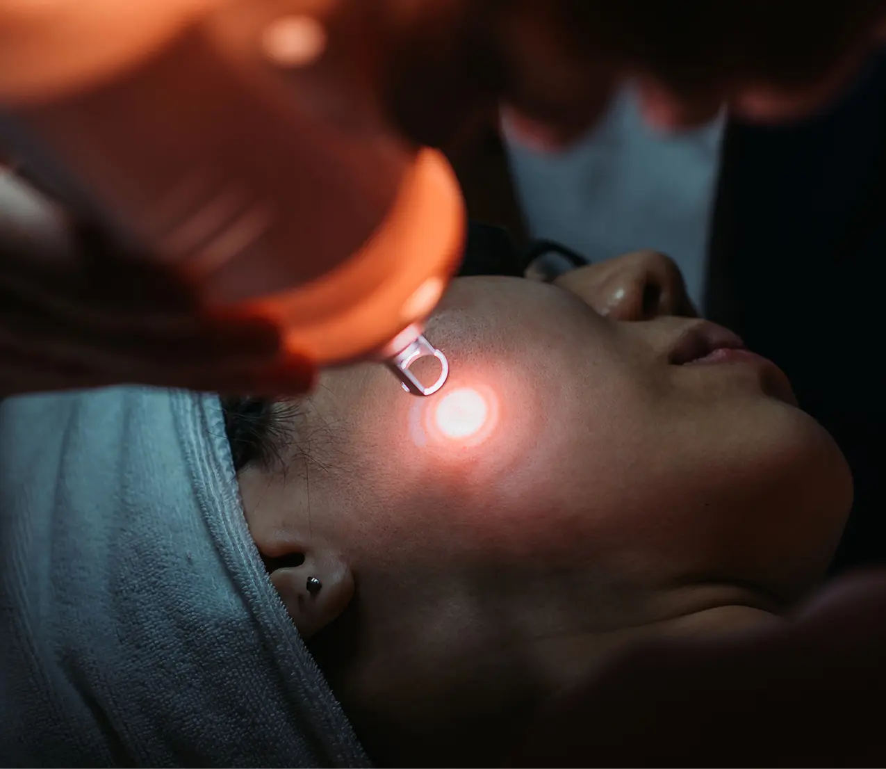 Facial laser therapy in progress