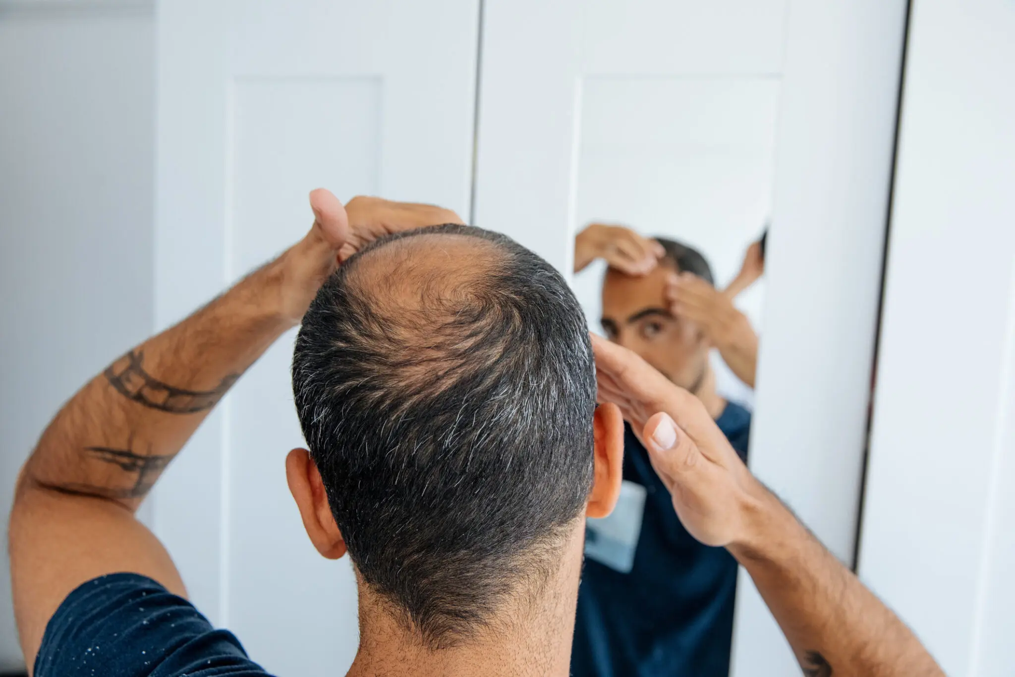 Individual looking at bald spot in mirror