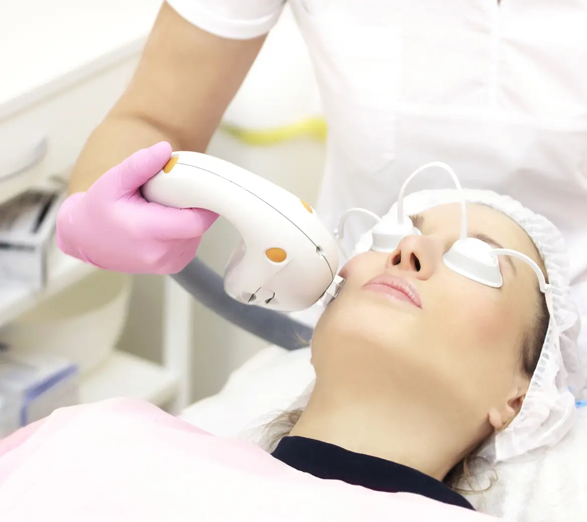 Laser treatment on woman's face